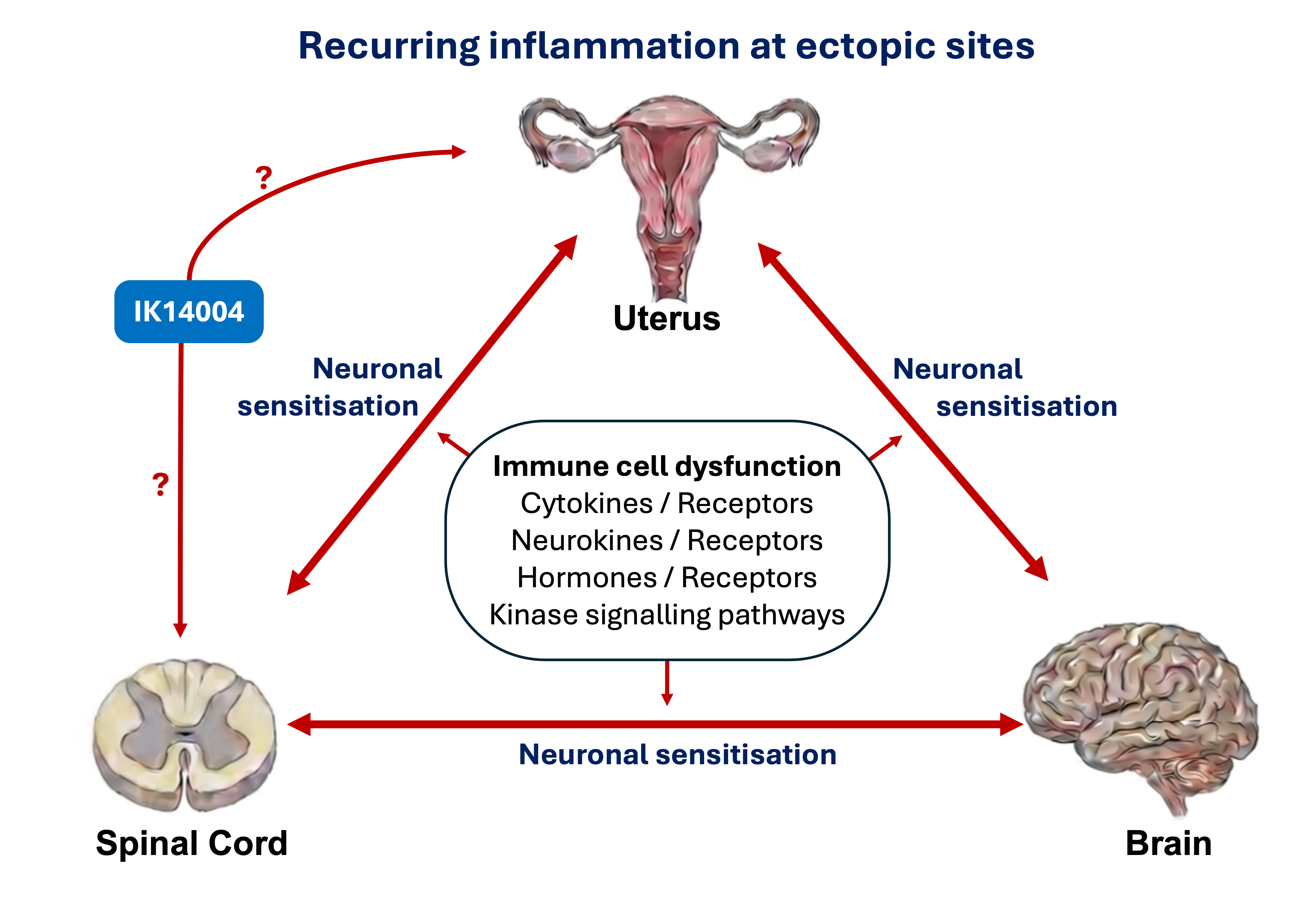 Illustration of endometriosis and immune dysfunction